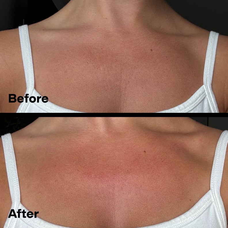 before and after of the Cyklar Vitamin C Body Oil Review