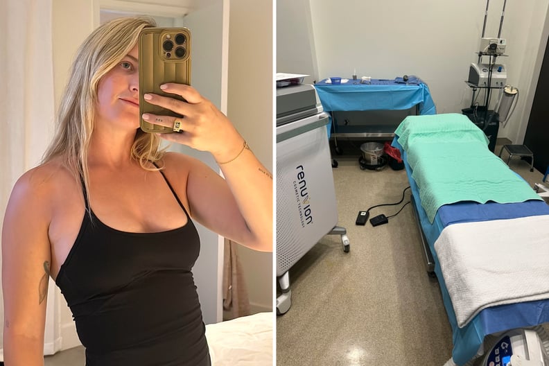 airsculpt before and after