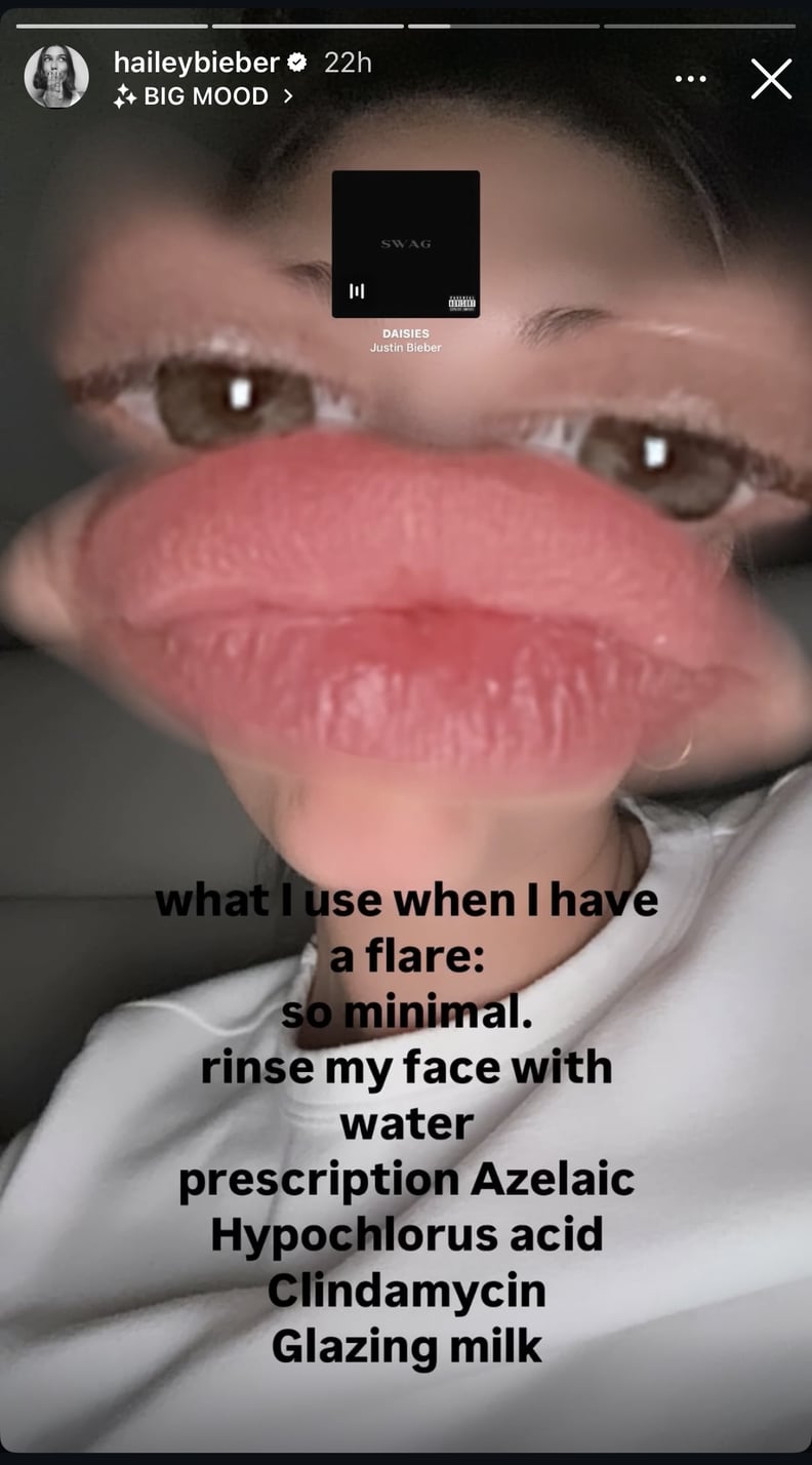 Hailey Bieber Dermatitis