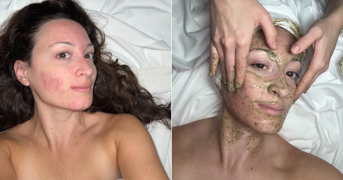 I Tried a Fiberglass Facial: Editor Experiment