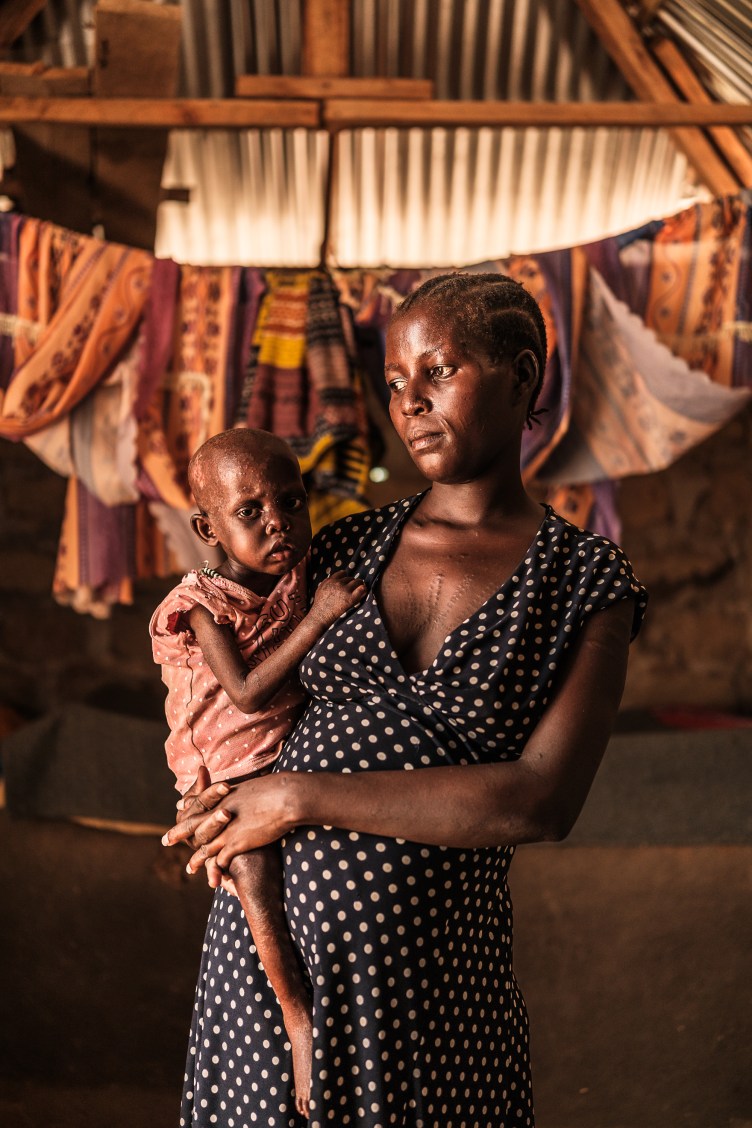 A woman with neat cornrows in a polka-dot dress stands looking down and away from the camera indoors. On her hip, she holds an emaciated child in a loose spotted shirt and beaded necklace. He stares at the camera, his mouth slightly open. Behind them, blankets are hanging from a line.