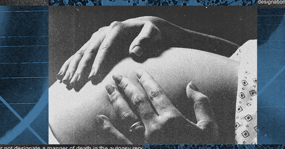 Les médecins légistes préviennent que le test de flotteur pulmonaire pourrait être dangereux – ProPublica