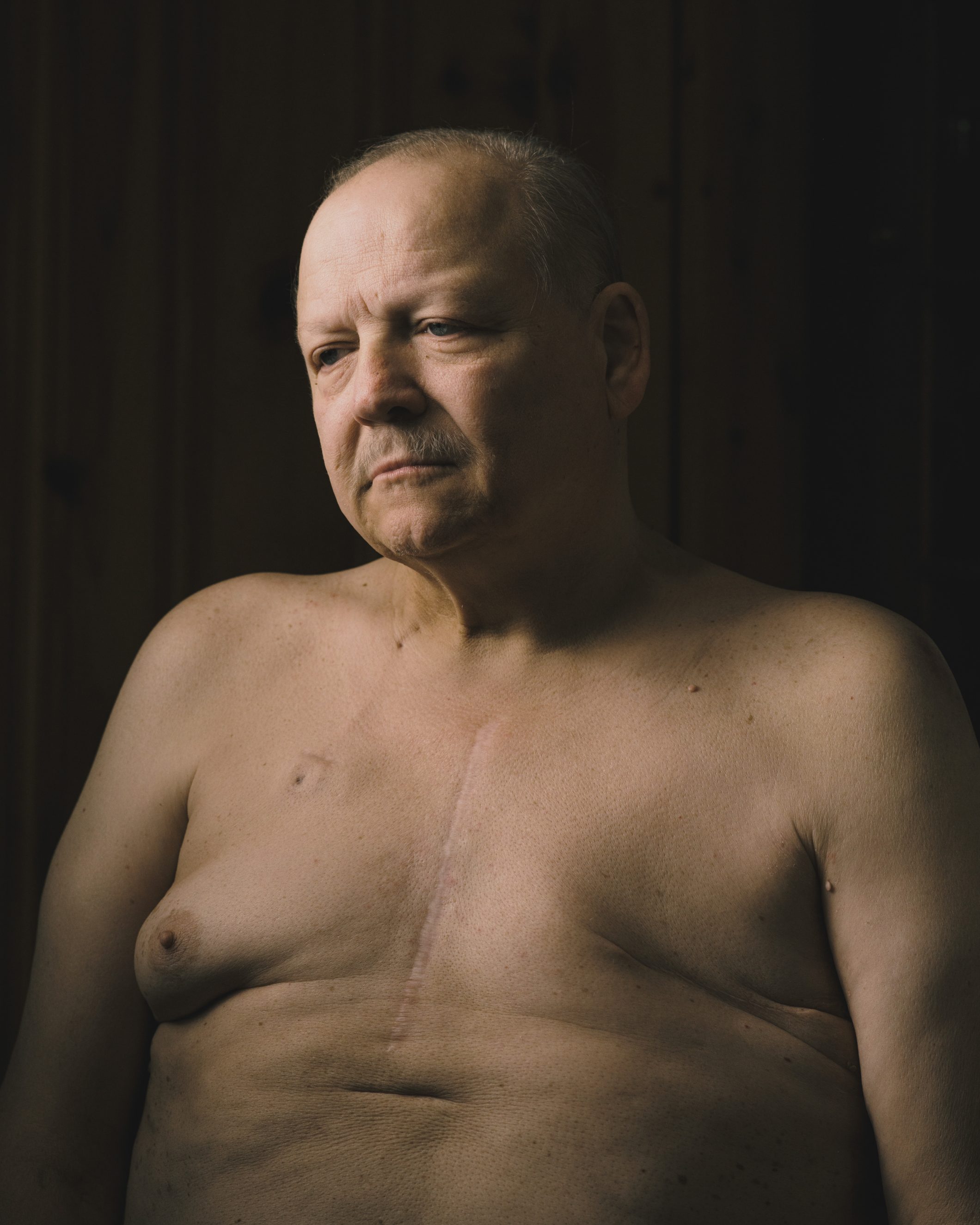 Ein grauhaariger Mann mit sanften blauen Augen sitzt vor einem dunklen Stoffhintergrund mit dramatischer Beleuchtung und blickt zur Seite. Er trägt kein Hemd und zeigt eine große Narbe, die in der Mitte seiner Brust und über die Stelle verläuft, an der seine linke Brust entfernt wurde.