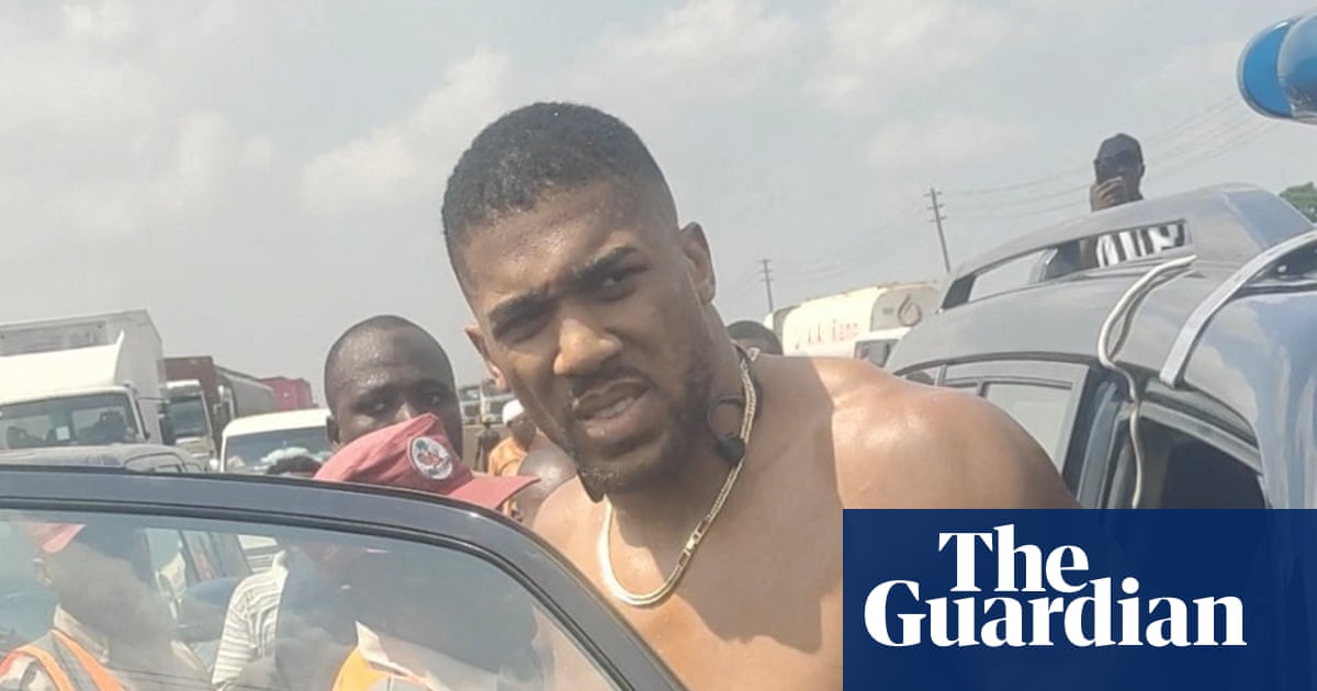 Anthony Joshua est sorti de l'hôpital au Nigeria après un accident de voiture | Antoine Josué