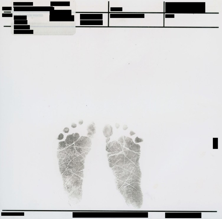 Une paire d'empreintes de pas d'enfant à l'encre noire, centrées sur une page blanche. Au-dessus et au-dessous des empreintes se trouvent plusieurs rangées de champs de formulaire officiels et d’informations d’identification, tous noircis par des barres noires pleines.
