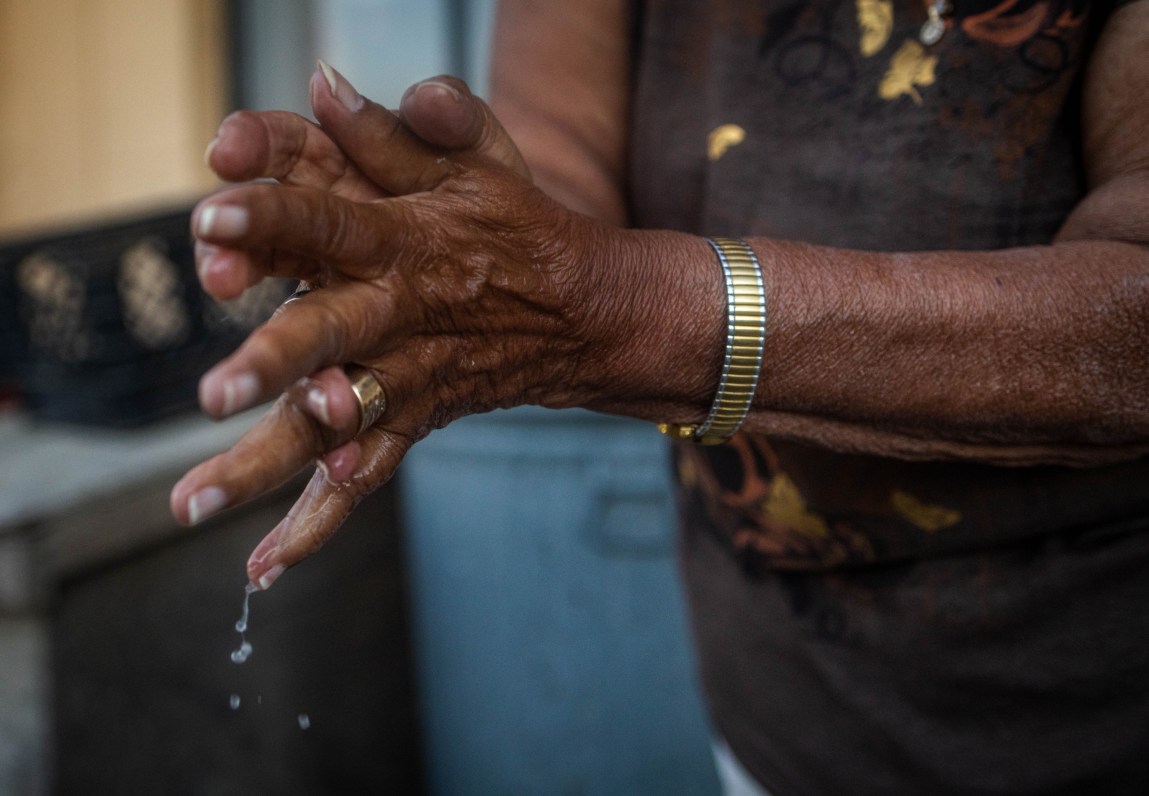 A close-up of a person’s weathered hands being washed, with water dripping from their fingers. She is wearing a gold ring and a metallic watchband.