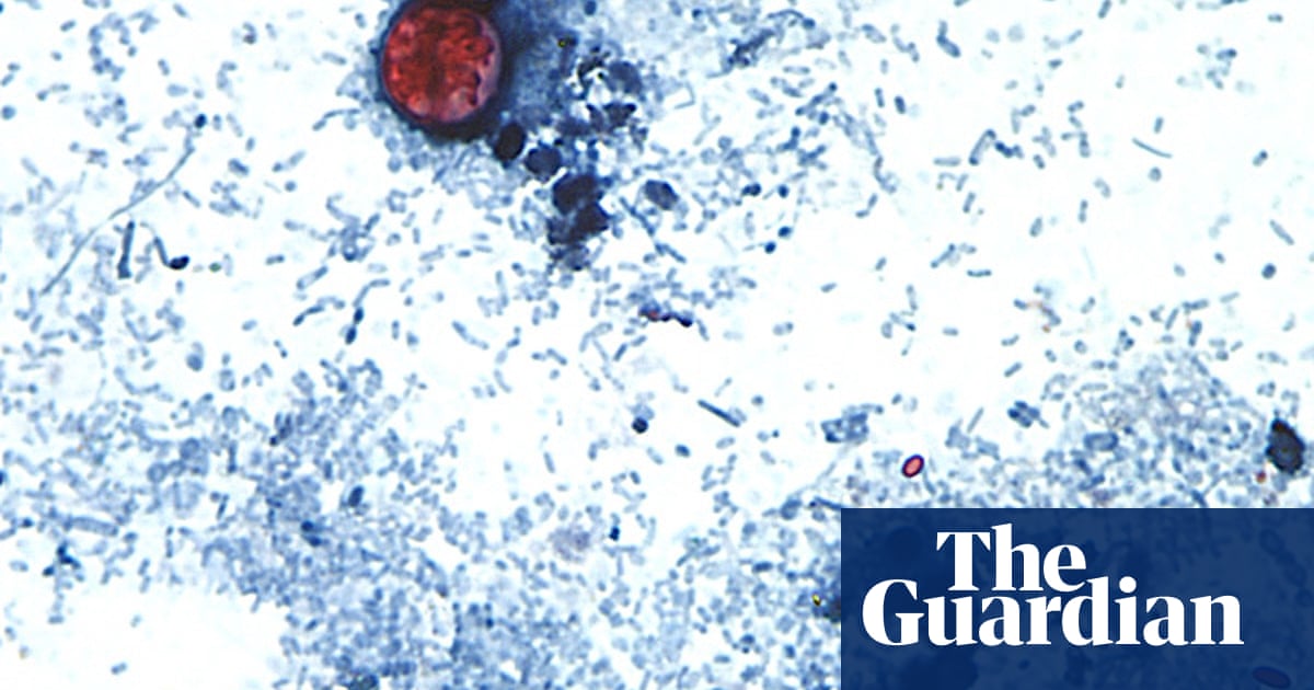 Aux États-Unis, l'épidémie de parasite responsable de la « diarrhée aqueuse » s'élève à plus de 2 800 cas | Soins de santé aux États-Unis