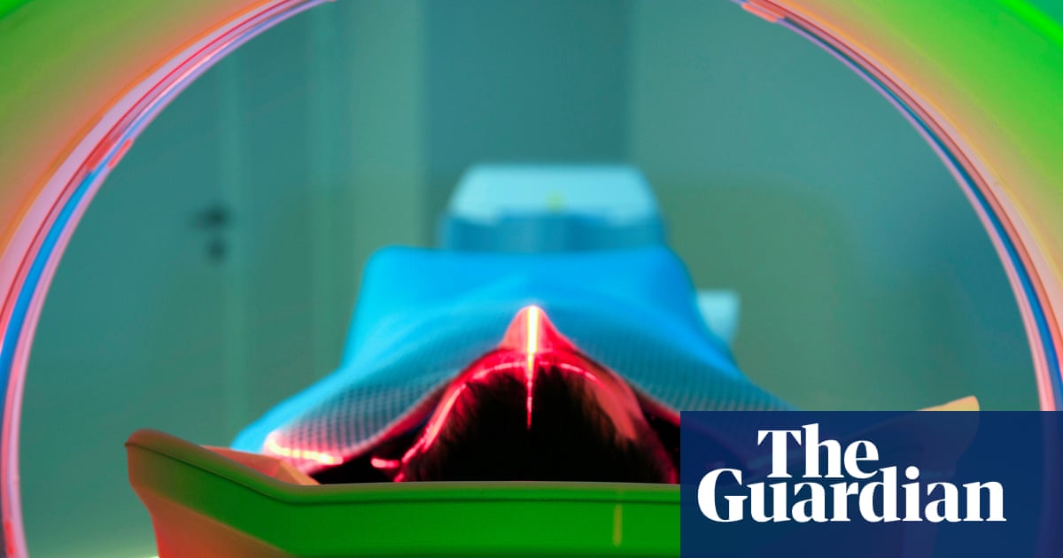 Cancer rates rising more quickly among younger people, international study finds | Cancer